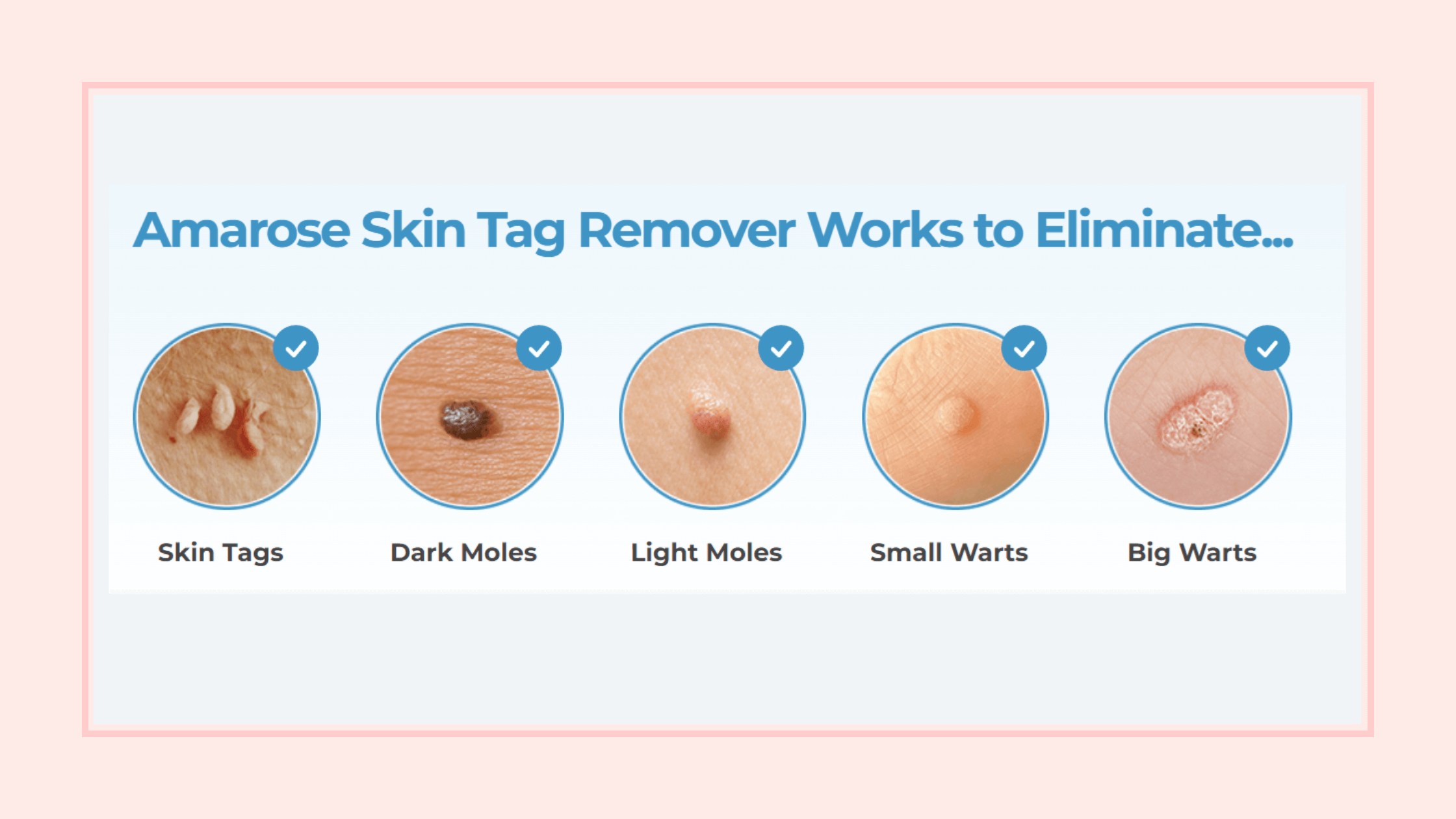Amarose Skin Tag Remover Benefits