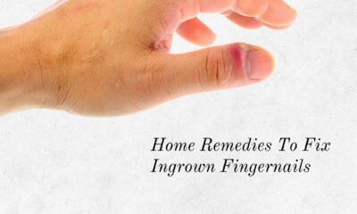 How To Treat Ingrown Fingernails At Home