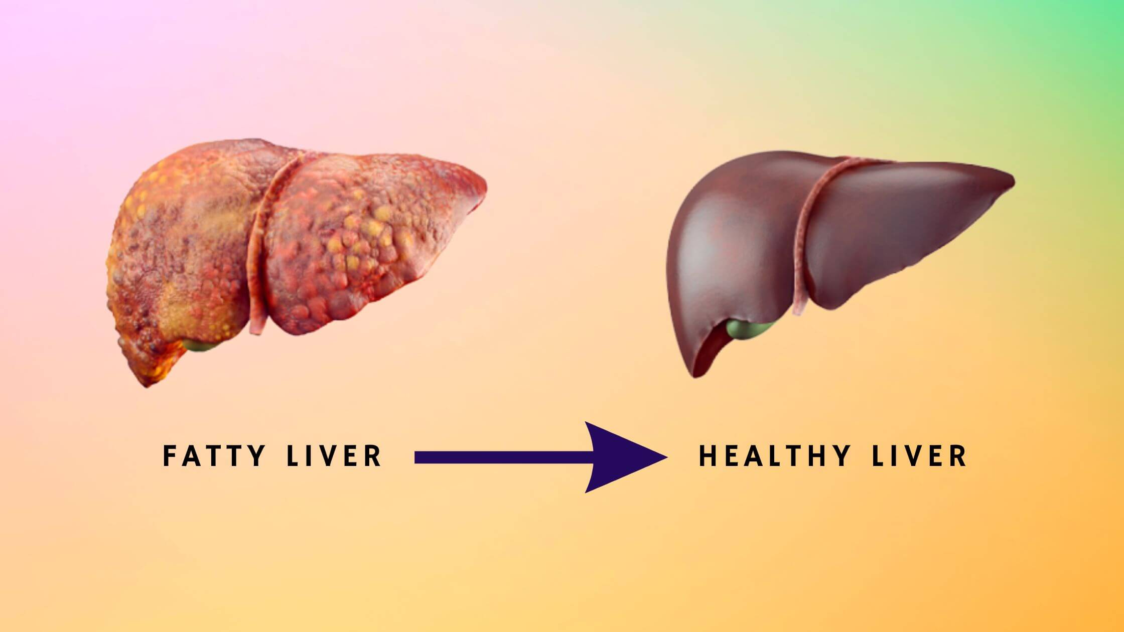 The Non-Alcoholic Fatty Liver Disease Solution Benefits
