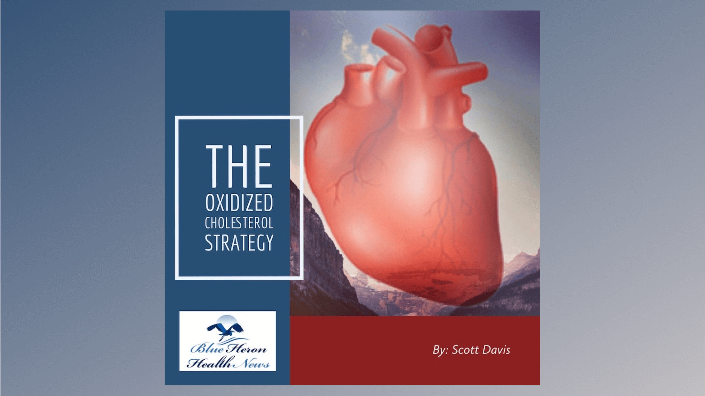 The Oxidised Cholesterol Strategy Reviews