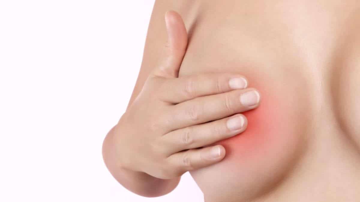 Common Causes For Dry Nipple