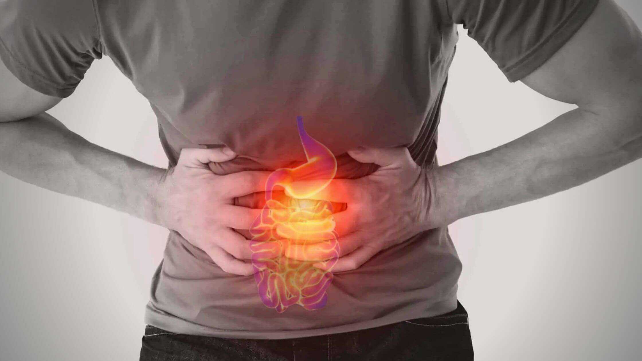In Mice The Experimental Anti-Obesity Drug Lowers Intestinal Inflammation