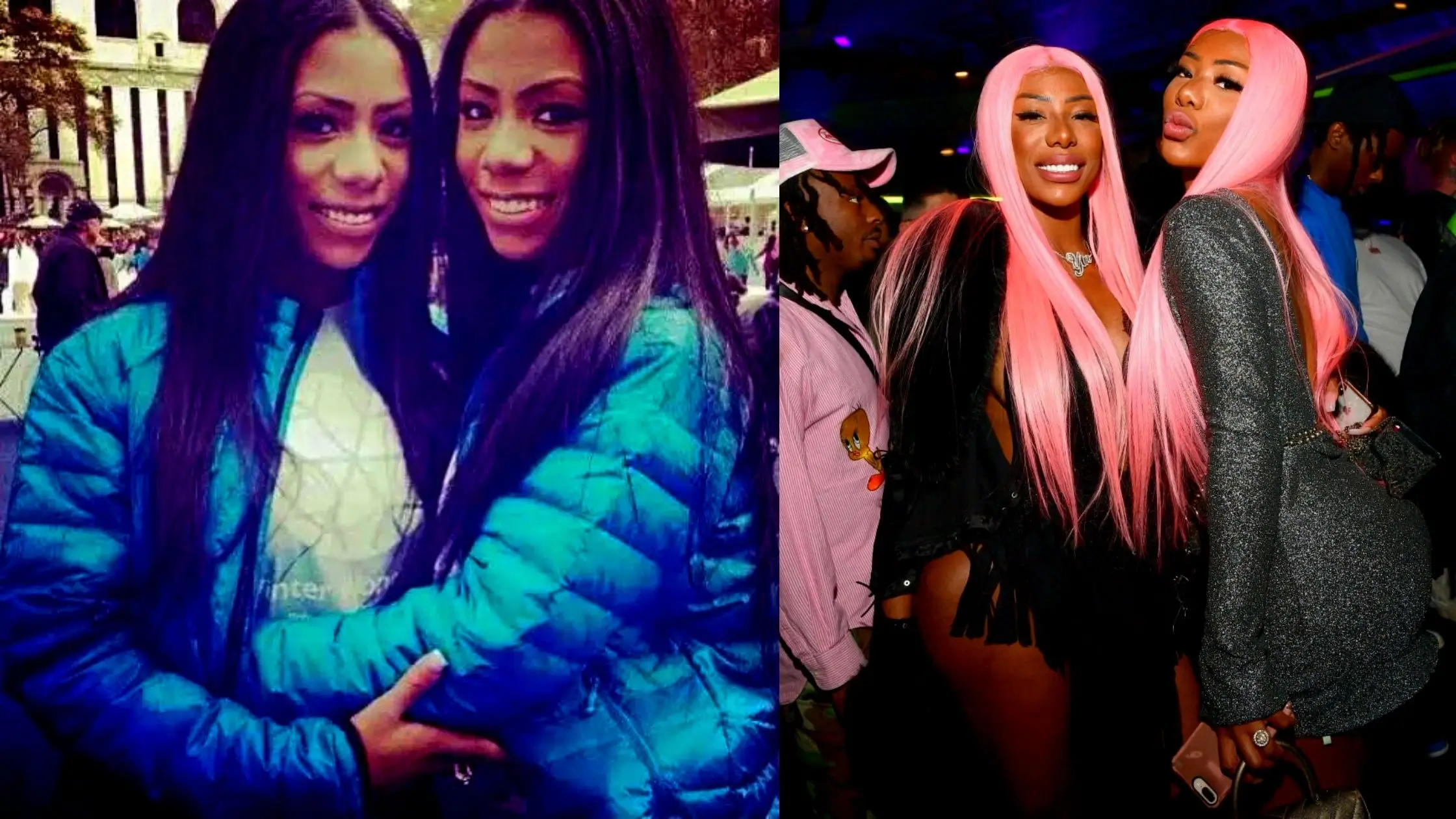 Clermont Twins Plastic Surgery Comparing Before And After Photos