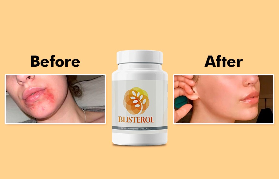 Blisterol Results