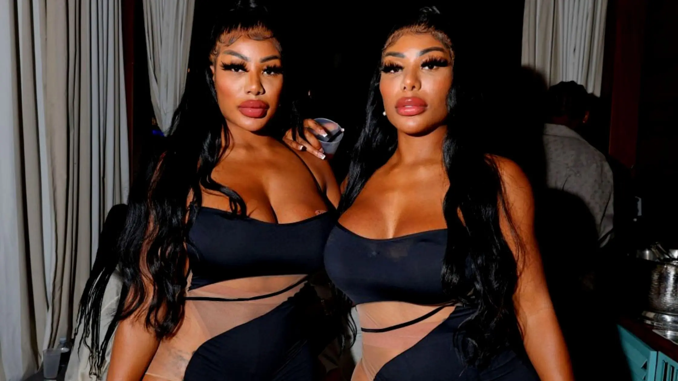 Clermont Twins' Plastic Surgery Comparing Before And After Photos