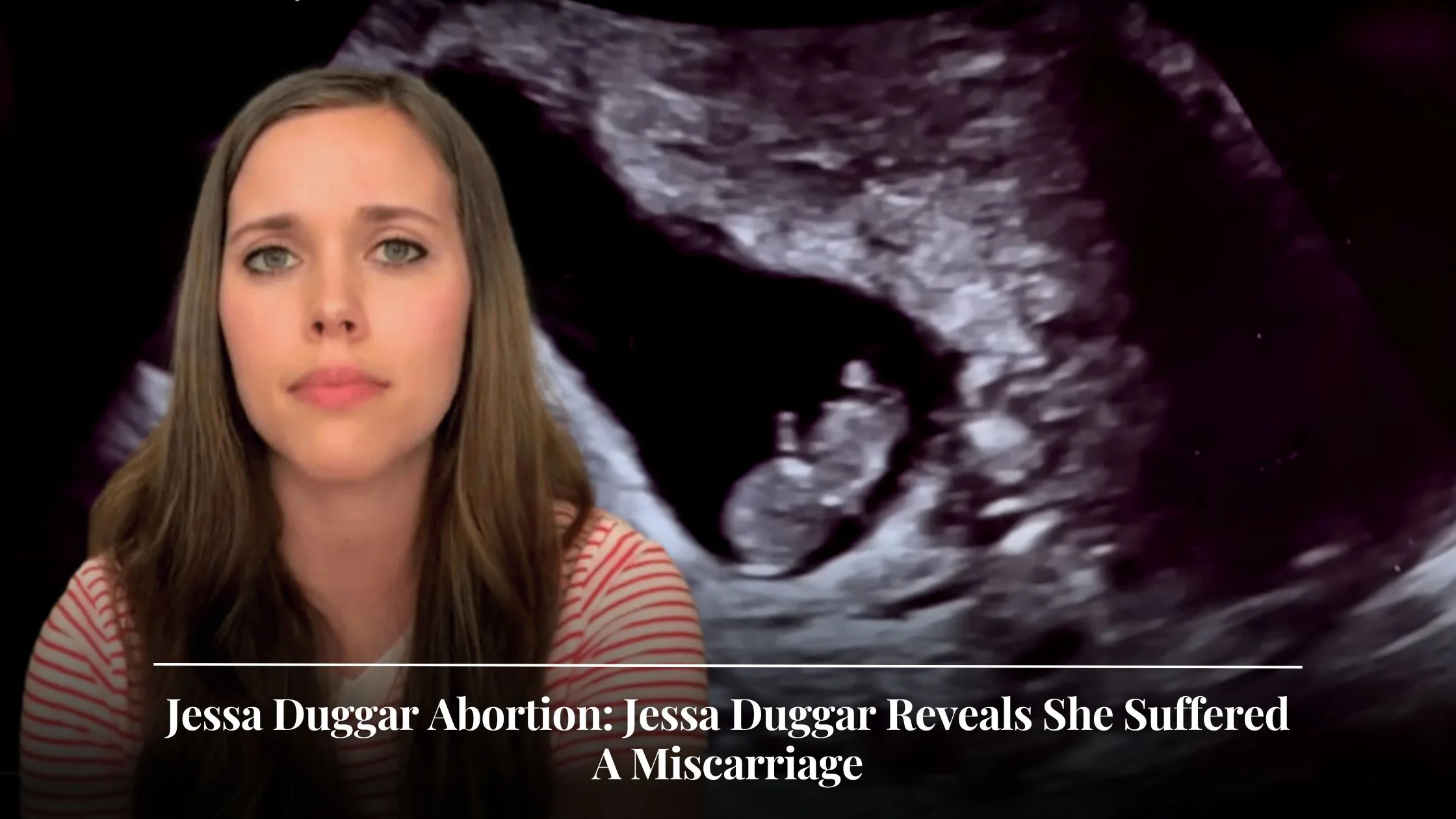 Jessa Duggar Abortion Jessa Duggar Reveals She Suffered A Miscarriage