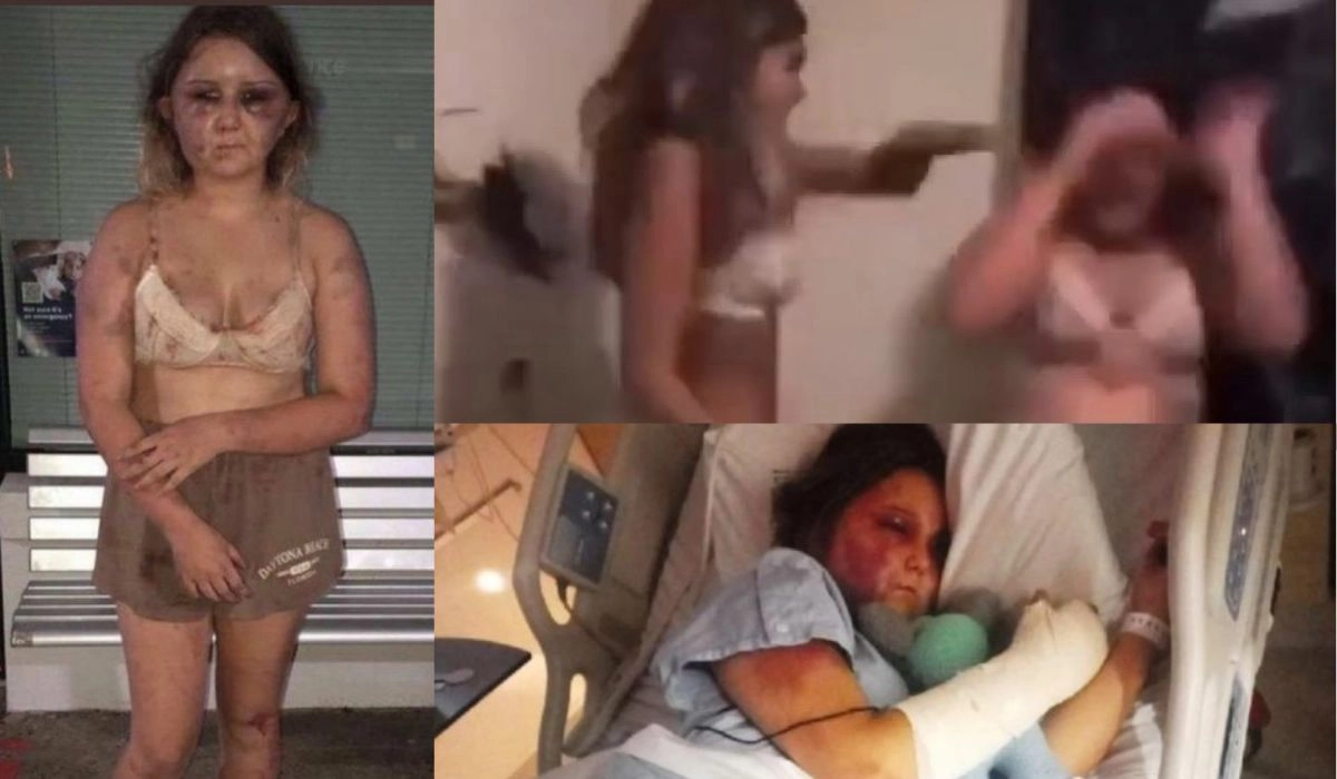 Chloe Denman Kirra Hart Attack Video Girl Stabbed At Sleepover