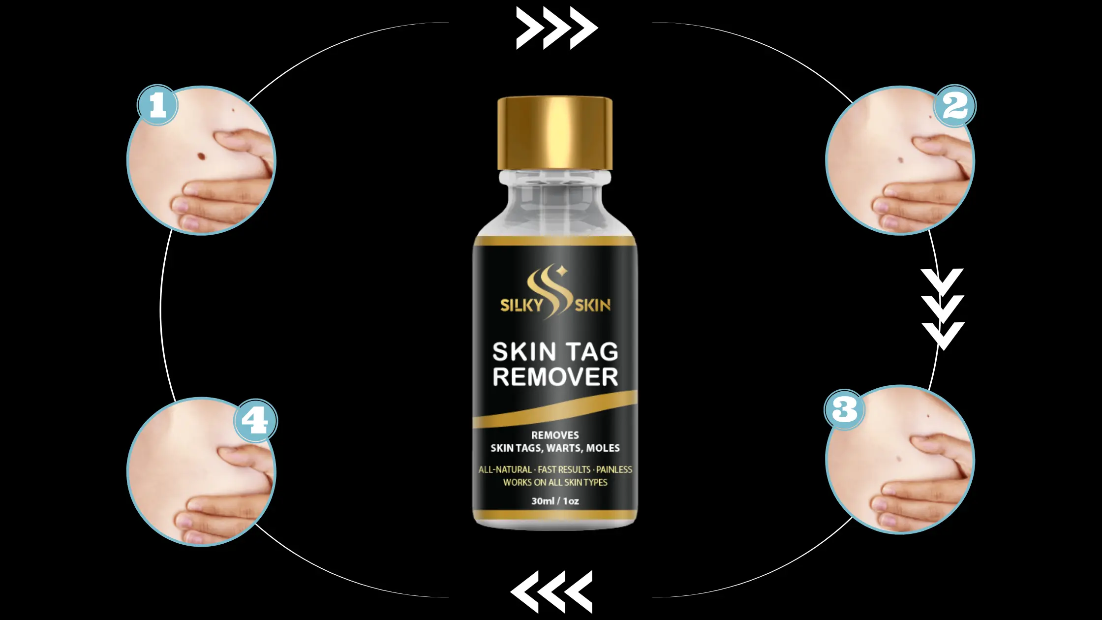 Silky Skin Tag Remover Results