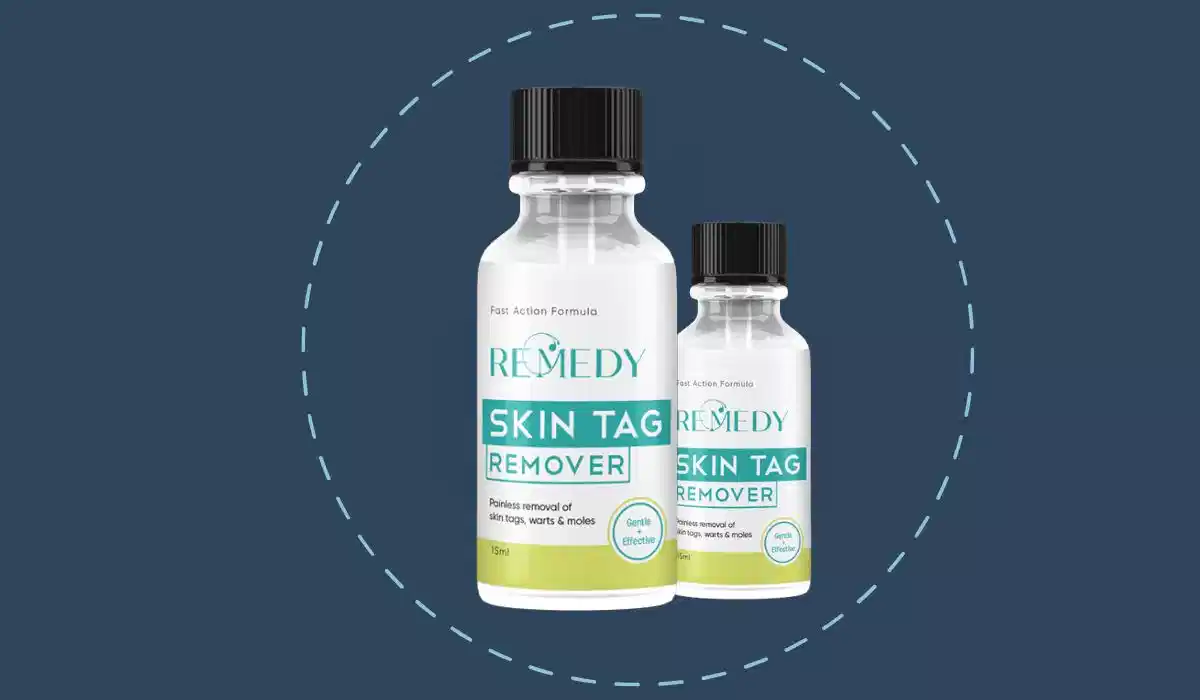 Remedy Skin Tag Remover Review